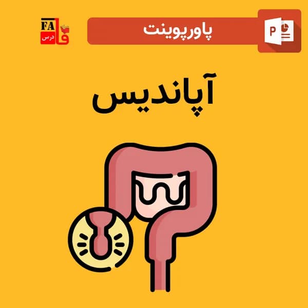 پاورپوینت آپاندیس