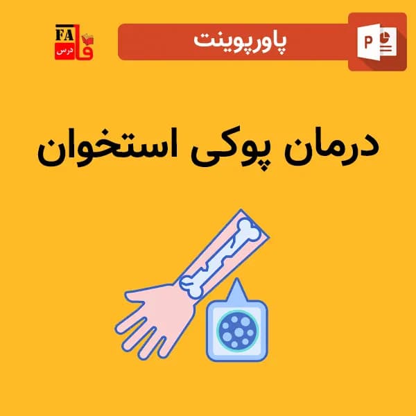 پاورپوینت درمان پوکی استخوان