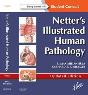 دانلود کتاب Netters Illustrated Human Pathology, Updated Edition L Maximilian