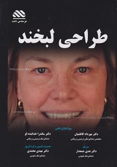 طراحی لبخند راهنمای کلینیکی برای دندانپزشکان سرامیست ها و بیماران