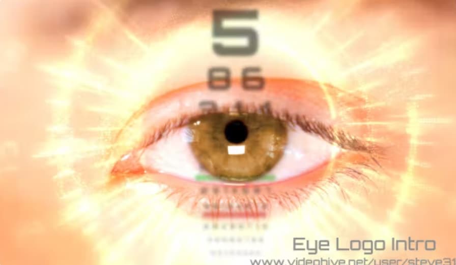 پروژه افترافکت لوگوی چشم،کلینیک بینایی سنجی چشم Eye Logo Optometry Eye Clinic