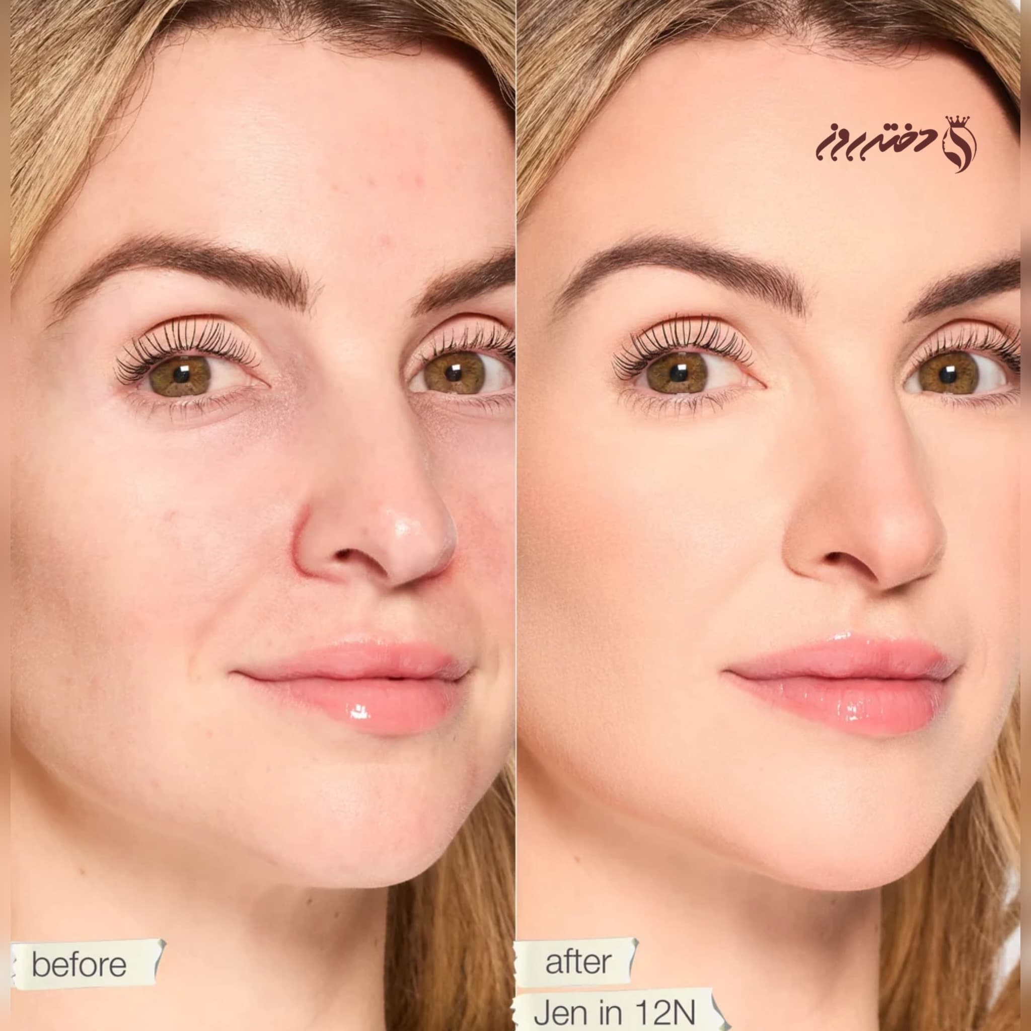 کانسیلر تارت | Double duty beauty concealer tarte 12N — تصویر ۲
