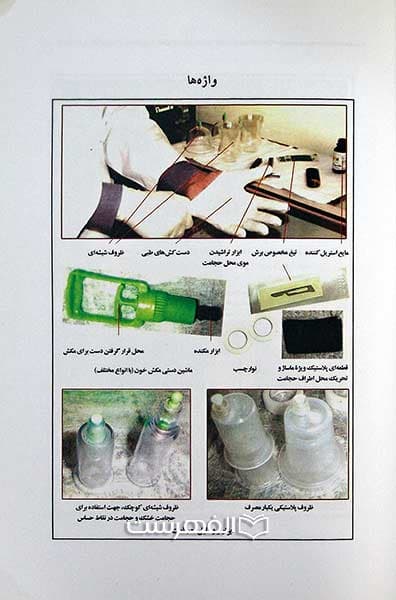 حجامت، شفای دردها — تصویر ۲