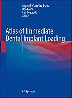 دانلود کتاب Atlas of Immediate Dental Implant Loading — تصویر ۲