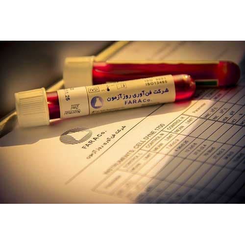 خون کنترل High سل کانتر SYSMEX K_1000 فن اوری روز ازمون