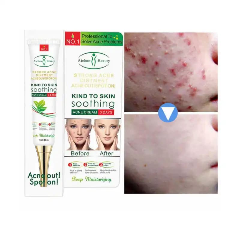 کرم ضد جوش فوری ایچون بیوتی تیوپی — تصویر ۲