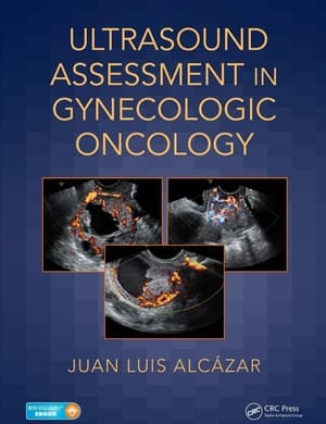 دانلود کتاب ULTRASOUND ASSESSMENT IN GYNECOLOGIC ONCOLOGY