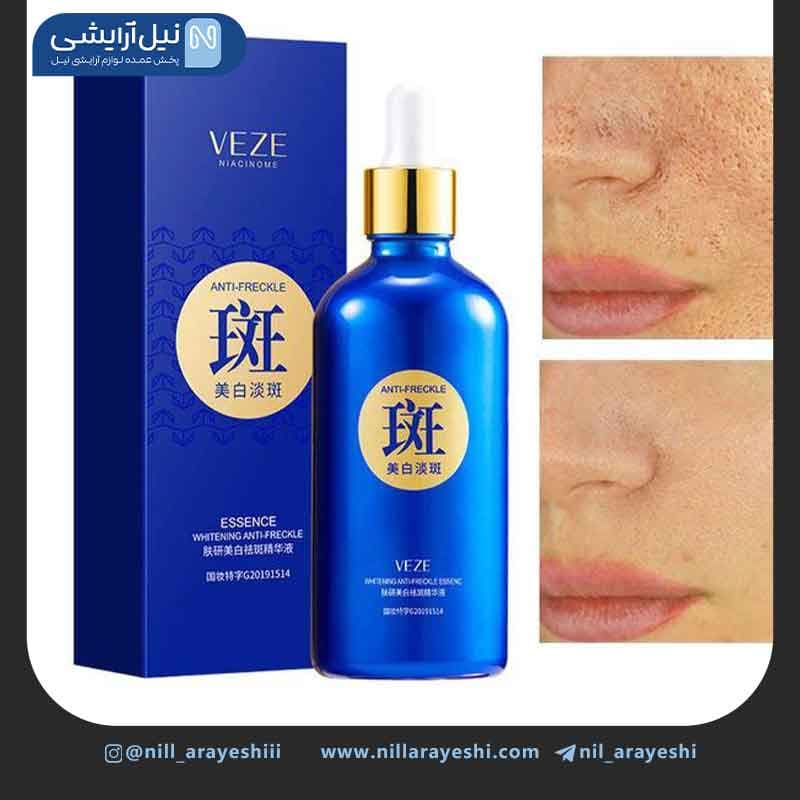 سرم صورت ضد لک و روشن کننده وزه کد FZ54802 — تصویر ۳