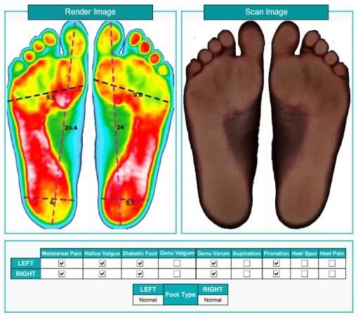 اسکنر دو بعدی کف پا مدل PT-2D Plantar — تصویر ۳
