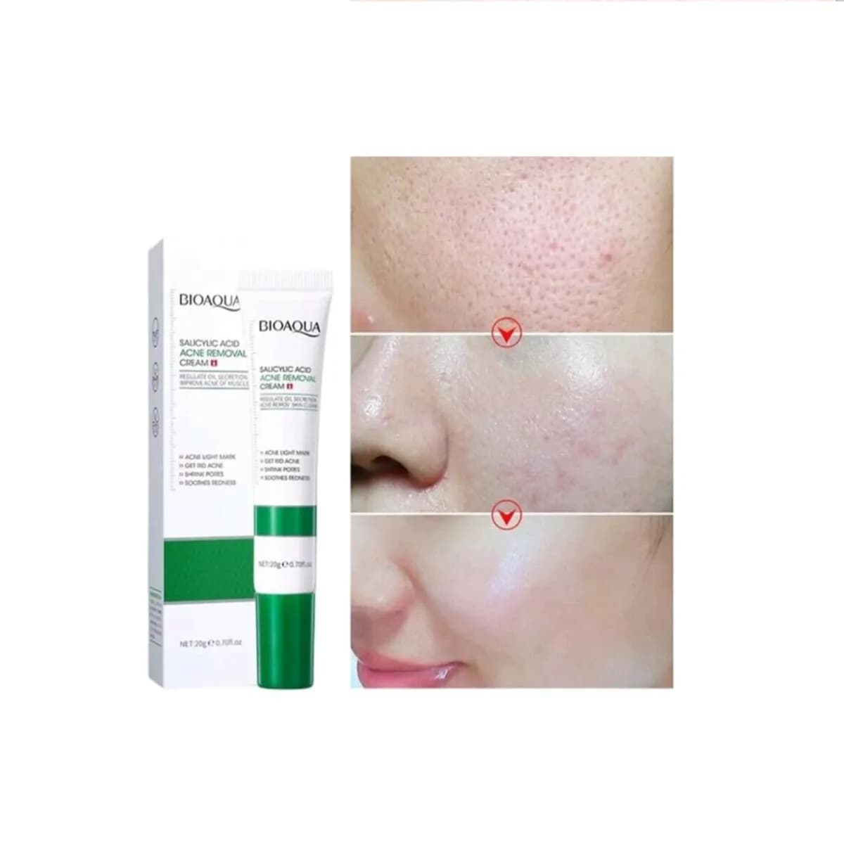 کرم ضد جوش اورژانسی بیواکوا مدل سالیسیلیک اسید BIOAQUA removal of acne — تصویر ۲