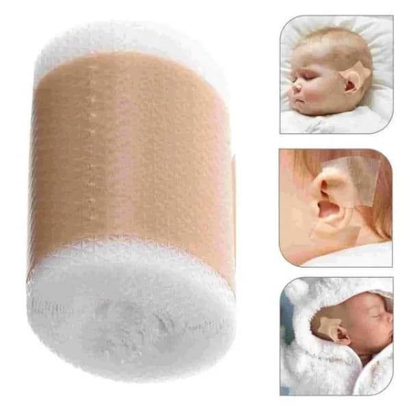 چسب اصلاح فرم گوش نوزاد چیکو یک متری — تصویر ۳