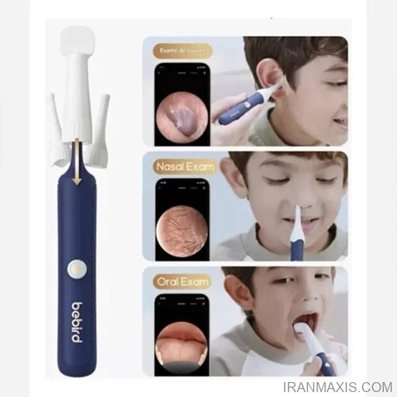 گوش پاک کن هوشمند Bebird مدل Bebird EarSight Plus Smart Ear Cleaner | EarSight Plus — تصویر ۲
