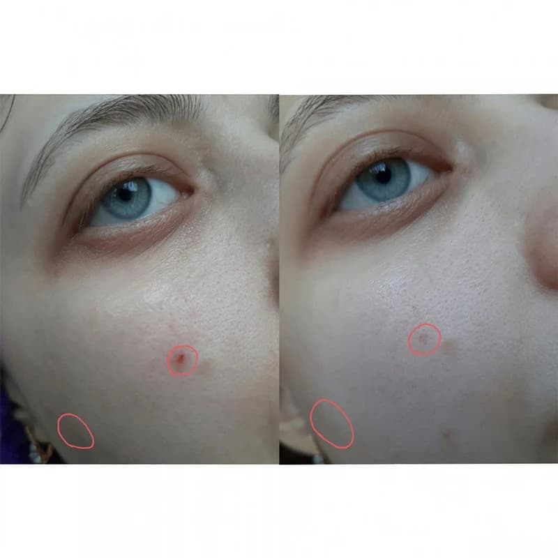 کرم نقطهای ضدلک و ضد جوش تیام مدل AC Fighting Spot RX Cream حجم 30 گرم — تصویر ۸
