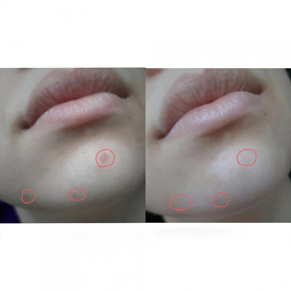 کرم نقطهای ضدلک و ضد جوش تیام مدل AC Fighting Spot RX Cream حجم 30 گرم — تصویر ۷