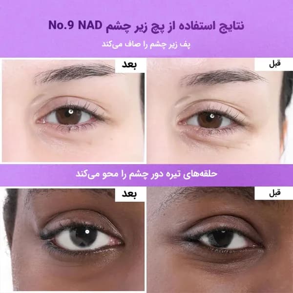 پچ زیر چشم ضد چروک پف و تیرگی نامبوزین نامبر9 | اصل — تصویر ۶