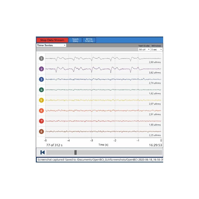 کیت کلاه الکترود ThinkPulse™ Active Electrode 16-channel Starter — تصویر ۴