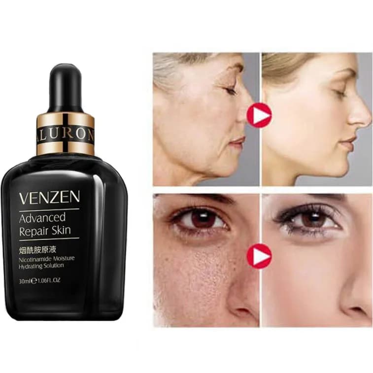 سرم ترمیم کننده نیکوتین آمید ونزن VENZEN حجم ۳۰ میل — تصویر ۸