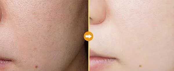 ماسک پیلاف سفید کننده آیچون بیوتی Aichun Beauty — تصویر ۲