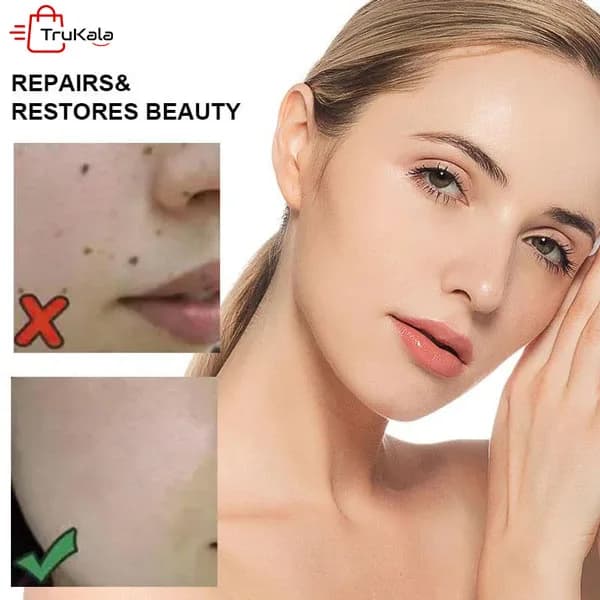 سرم ضد لک و روشن کننده نقطه ای برند وی اچ ای — تصویر ۴