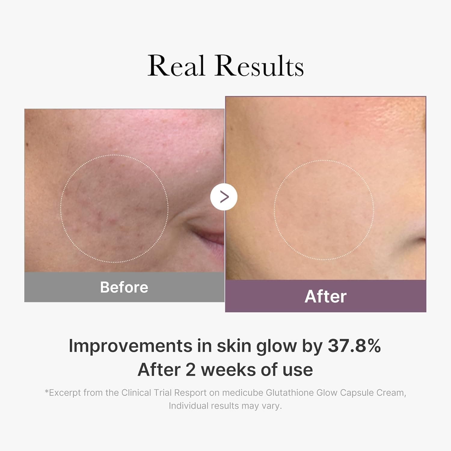 کرم کپسولی جوانساز و روشن کننده گلوتاتیون مدیکیوب Medicube AGE-R Glutathione Glow Capsule Cream مناسب برای انواع پوست حجم 50 میلی لیتر — تصویر ۶