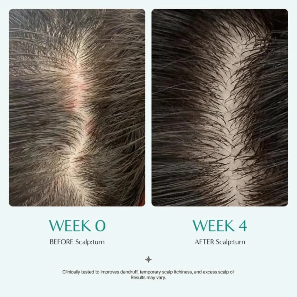 آمپول تقویت و مراقبت پوست سر لیلی ایو Scalp:Turn Cica PDRN Brush Ampoule — تصویر ۵