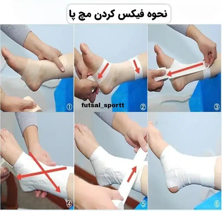 چسب گلو گلری — تصویر ۳
