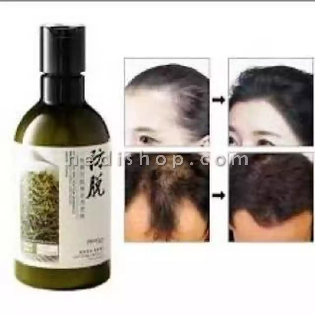 شامپو ضد ریزش اورجینال بیوآکوا با عصاره رزماری BIOAQUA — تصویر ۳