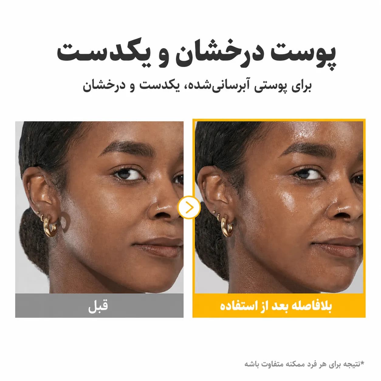 سرم ضد لک گلوتاتیون و ویتامین C نامبوزین شماره ۵ پلاس حجم ۳۰ میل | Numbuzin No.5+ Glutathione Vitamin Concentrated Serum — تصویر ۴