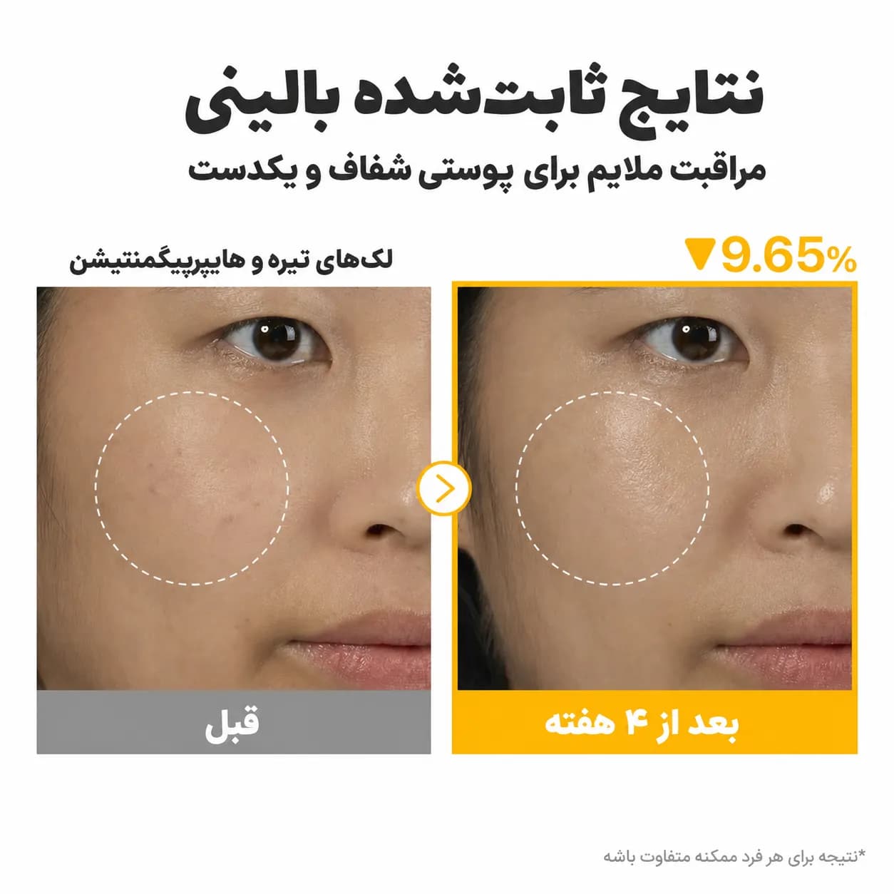 سرم ضد لک گلوتاتیون و ویتامین C نامبوزین شماره ۵ پلاس حجم ۳۰ میل | Numbuzin No.5+ Glutathione Vitamin Concentrated Serum — تصویر ۶