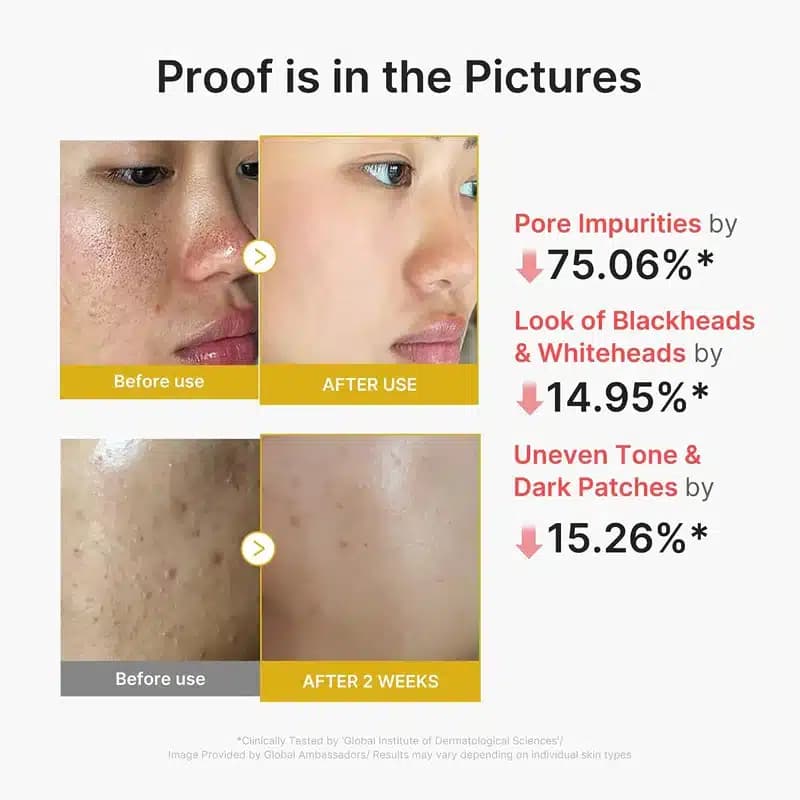 سرم لایه بردار و روشن کننده مدی کیوب Medicube حاوی کوجیک اسید و زردچوبه مدل Kojic Acid Turmeric Peel Shot (80 میل) — تصویر ۳