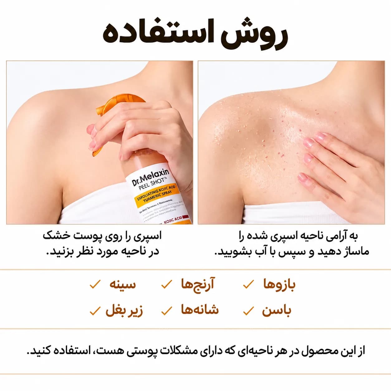 اسپری لایه بردار بدن دکتر ملاکسین کوجیک اسید و زردچوبه ۲۰۰ میل | Dr.Melaxin Peel Shot — تصویر ۳