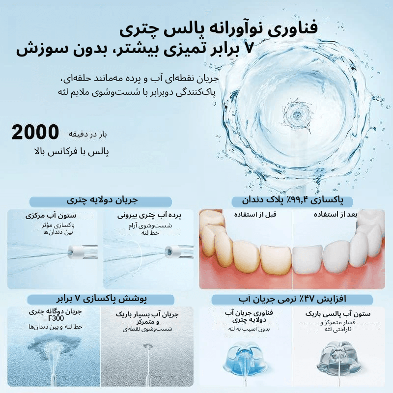 واترجت دهان و دندان شیائومی میجیا مدل F300 کد MEO703 — تصویر ۶