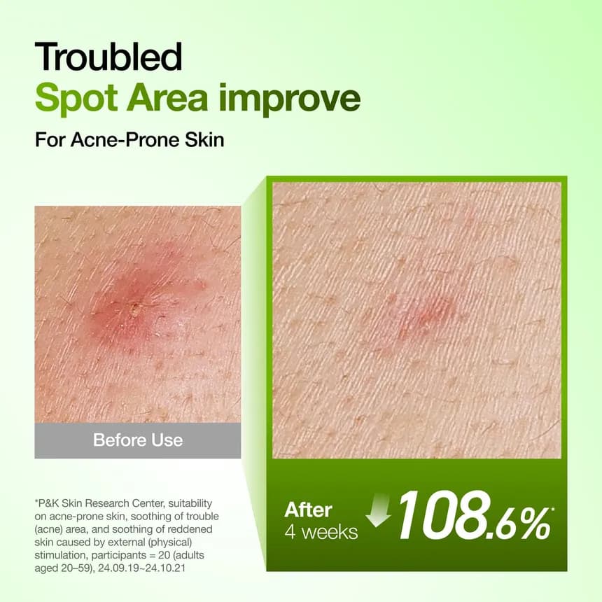 سرم تسکین دهنده ضد قرمزی آزلائیک اسید 10% و هیالورون آنوا (نسخه نتفلیکس) 50 میل — تصویر ۴