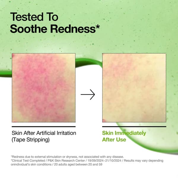 سرم ضدالتهاب و قرمزی آنوا مدل Azelaic Acid 10 — تصویر ۳