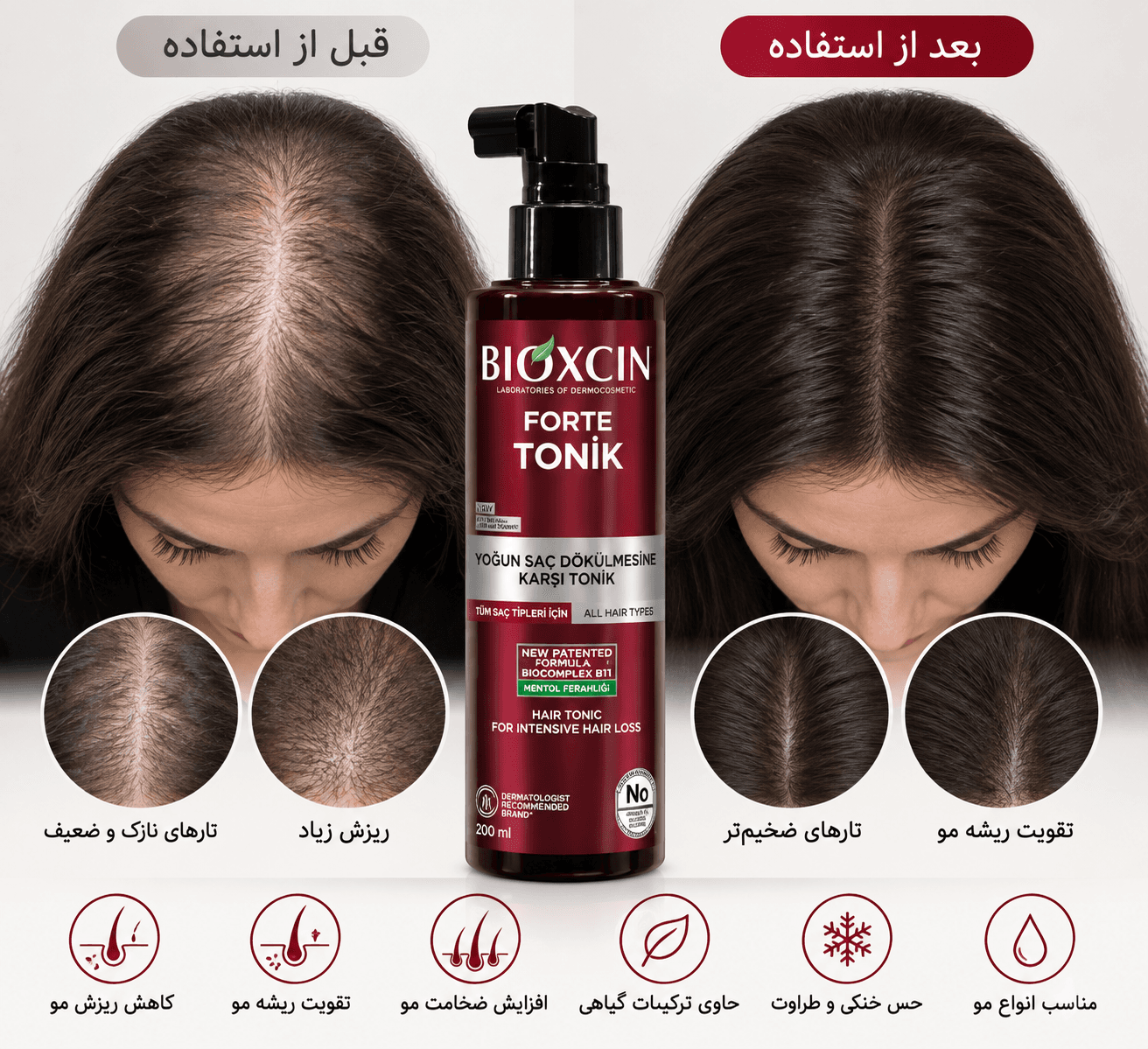 تونیک ضدریزش مو فورت بیوکسین — تصویر ۲