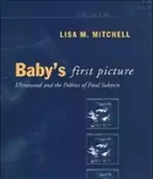 دانلود کتاب Baby’s First Picture: Ultrasound and the Politics of Fetal Subjects