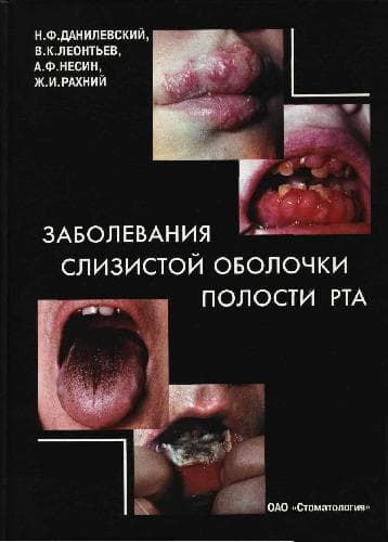 دانلود کتاب АТЛАС Заболевания слизистой полости рта