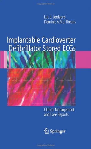 دانلود کتاب Implantable Cardioverter Defibrillator Stored ECGs