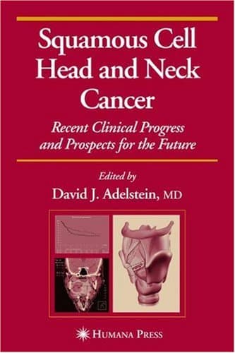 دانلود کتاب Squamous Cell Head and Neck Cancer Recent Clinical Progress Prospects for the Future