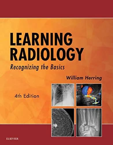 و دانلود نسخه کامل کتاب زبان اصلی Learning Radiology: Recognizing the Basics PDF | دانلود کتاب خارجی