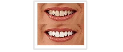 آموزش آرایش چهره به کمک فوتوشاپ