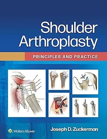 و دانلود نسخه کامل کتاب زبان اصلی Shoulder Arthroplasty: Principles and Practice PDF | دانلود کتاب خارجی