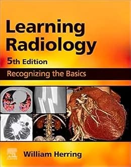 و دانلود نسخه کامل کتاب زبان اصلی Learning Radiology E-Book: Recognizing the Basics PDF | دانلود کتاب خارجی