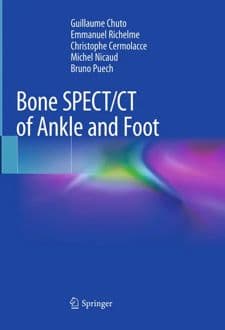 کتاب Bone SPECT/CT of Ankle and Foot