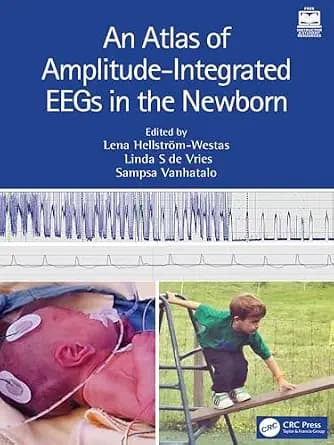 و دانلود نسخه کامل کتاب زبان اصلی An Atlas of Amplitude-Integrated EEGs in the Newborn PDF | دانلود کتاب خارجی