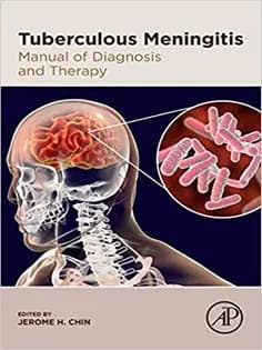 دانلود کتاب Tuberculous Meningitis: Manual of Diagnosis and Therapy