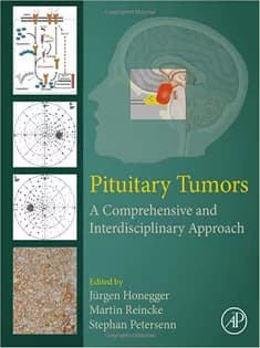 دانلود کتاب Pituitary Tumors: A Comprehensive and Interdisciplinary Approach