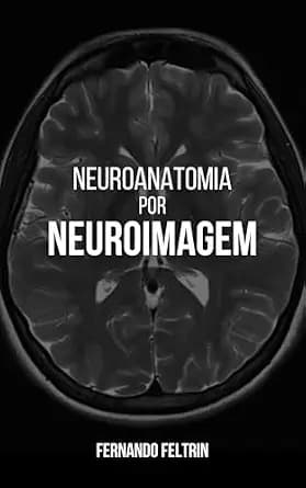 و دانلود نسخه کامل کتاب زبان اصلی NEUROANATOMIA POR NEUROIMAGEM (Portuguese Edition) PDF | دانلود کتاب خارجی