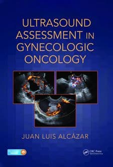 کتاب Ultrasound Assessment in Gynecologic Oncology