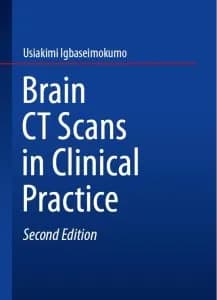 و دانلود نسخه کامل کتاب Brain CT Scans
